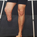 Leaked amputeex onlyfans leaked