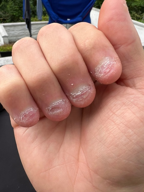 Leaked bittennails header onlyfans leaked