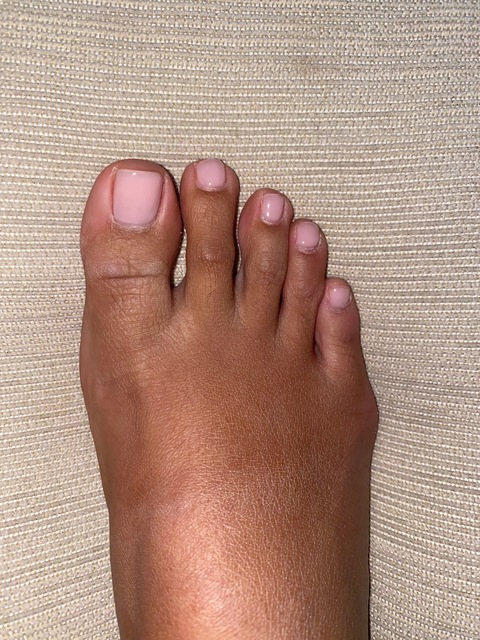 Leaked fetina header onlyfans leaked