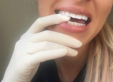 Leaked nursemollyx header onlyfans leaked